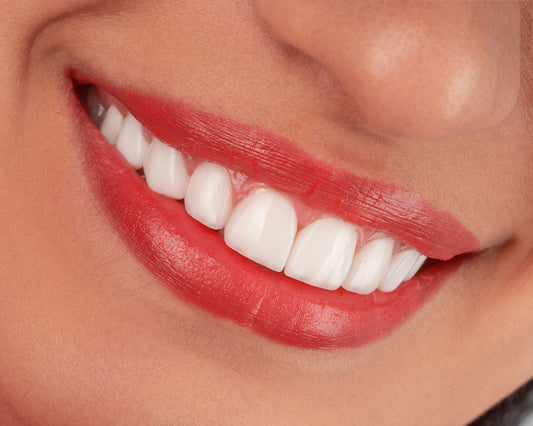 Close up of healthy white teeth representing strong remineralized enamel
