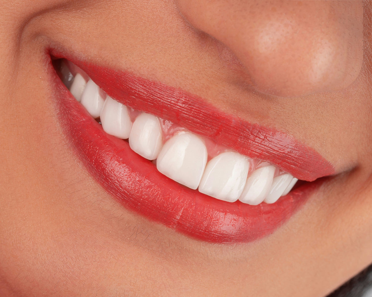 Close up of healthy white teeth representing strong remineralized enamel